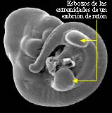 Mouse embryo limb buds